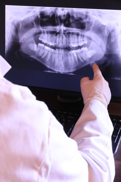 Best Urgent Dental Care for Toothache in Woodcliff Lake, NJ
