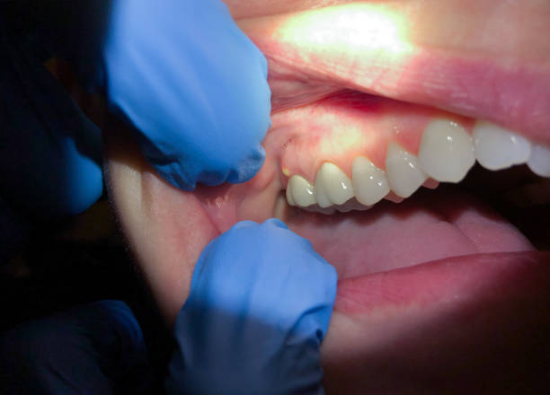 Best Mobile Emergency Dentist in Woodcliff Lake, NJ